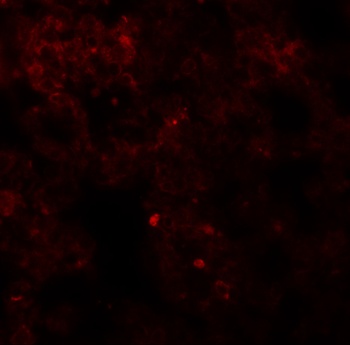Coronin 7 Antibody