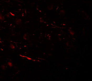 VPS13B Antibody