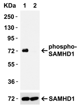 SAMHD1 (phospho Thr592) Antibody