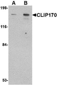 CLIP1 Antibody
