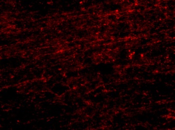 CLIP1 Antibody