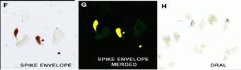 SARS-CoV-2 (COVID-19) Envelope Antibody