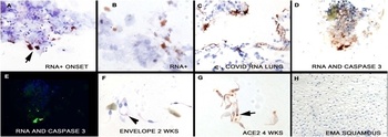 SARS-CoV-2 (COVID-19) Envelope Antibody