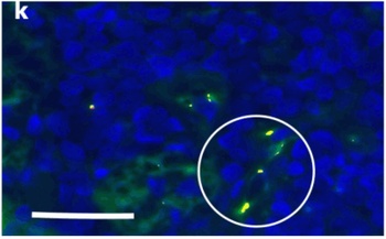 SARS-CoV-2 (COVID-19) Envelope Antibody