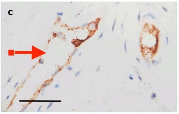 SARS-CoV-2 (COVID-19) Envelope Antibody