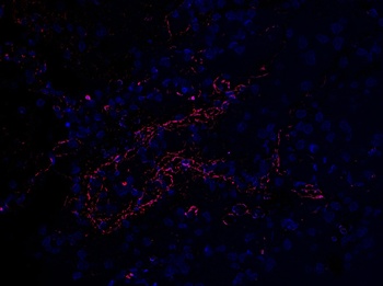 SARS-CoV-2 (COVID-19) Envelope Antibody