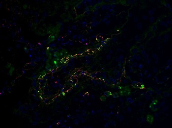 SARS-CoV-2 (COVID-19) Envelope Antibody