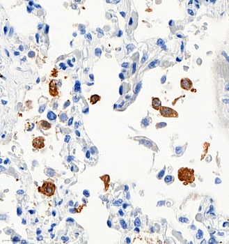 SARS-CoV-2 (COVID-19) Nucleocapsid Antibody