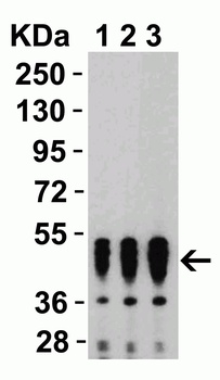 SARS-CoV-2 (COVID-19) Nucleocapsid Antibody