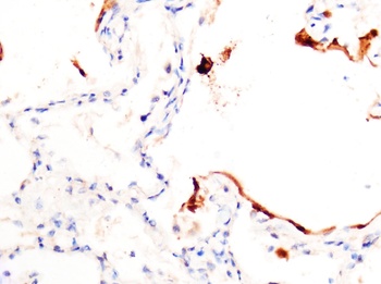 SARS-CoV-2 (COVID-19) Spike Antibody