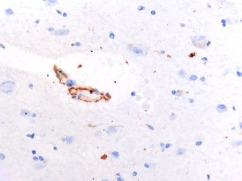 SARS-CoV-2 (COVID-19) Spike Antibody