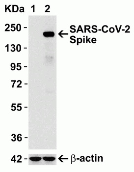 SARS-CoV-2 (COVID-19) Spike Antibody
