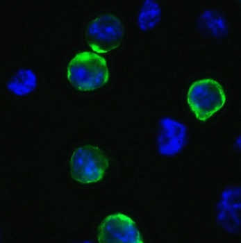 SARS-CoV-2 (COVID-19) Spike Antibody