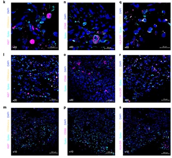 SARS-CoV-2 (COVID-19) Spike Antibody