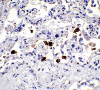 SARS-CoV-2 (COVID-19) Spike Antibody