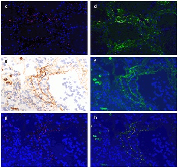 SARS-CoV-2 (COVID-19) Spike Antibody