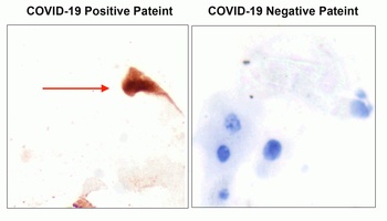 SARS-CoV-2 (COVID-19) Spike Antibody