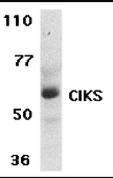 CIKS Antibody