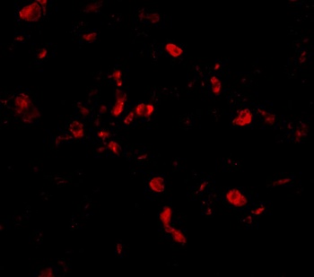 CIKS Antibody