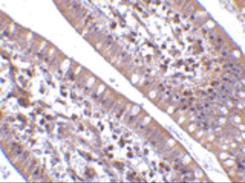 CIDEB Antibody