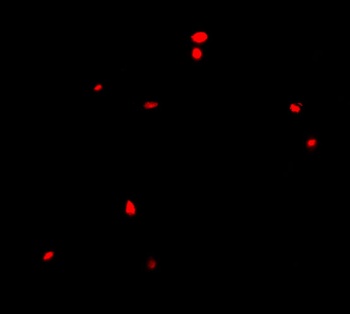 CIDE-B Antibody