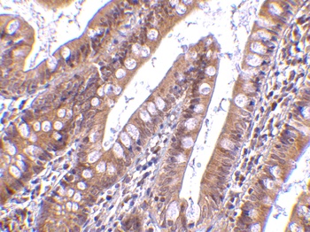 CIDE-B Antibody