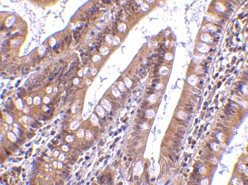 CIDEB Antibody