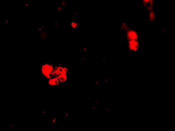 CIDE-B Antibody