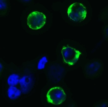 SARS-CoV-2 (COVID-19) Spike 681P Antibody