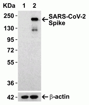 SARS-CoV-2 (COVID-19) Spike 681P Antibody