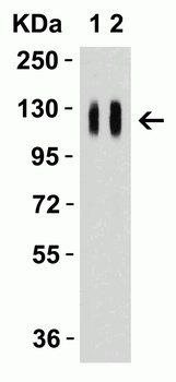 SARS-CoV-2 (COVID-19) Spike 681P Antibody