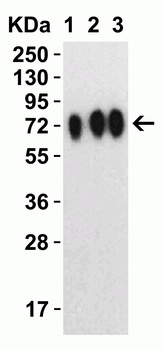 SARS-CoV-2 (COVID-19) Spike 681P Antibody