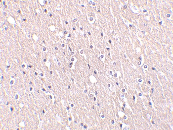 CIDE-A Antibody
