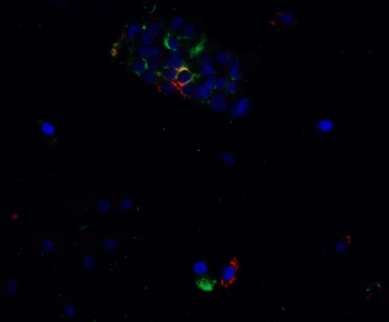 SARS-CoV-2 (COVID-19) Spike G142D Δ143-145VYY Antibody (Omicron)