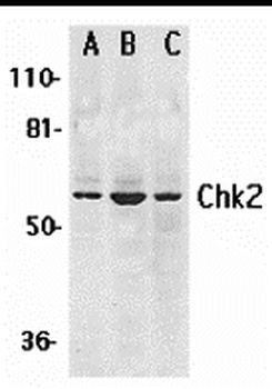 CHEK2 Antibody