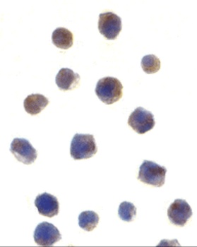 CHEK2 Antibody