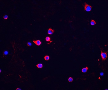 CHEK2 Antibody