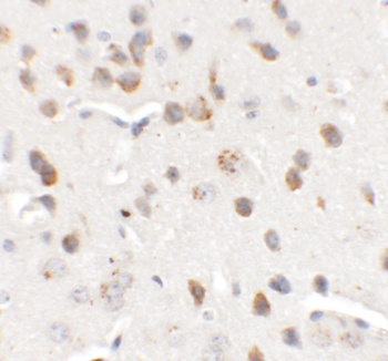 CHD7 Antibody