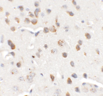 CHD7 Antibody