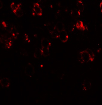 CHD7 Antibody