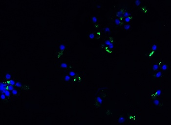 SARS-CoV-2 (COVID-19) Spike Q493R G496S Q498R N501Y Y505H Antibody (Omicron)