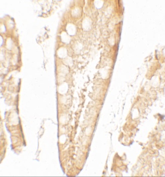 CFTR Antibody