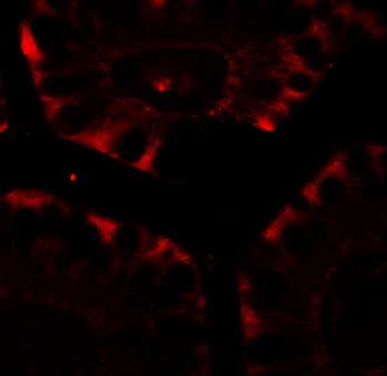 CFTR Antibody