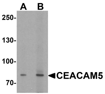 CEACAM5 Antibody