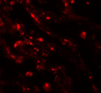 CEACAM5 Antibody