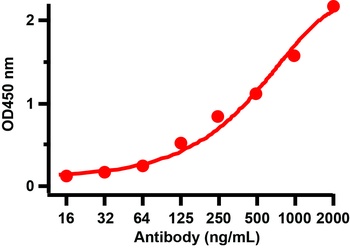 SARS-CoV-2 (COVID-19) Spike RBD Antibody