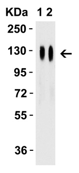 SARS-CoV-2 (COVID-19) Spike RBD Antibody