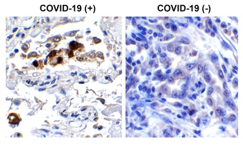 SARS-CoV-2 (COVID-19) Spike RBD Antibody