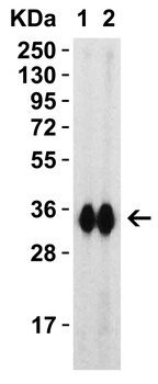 SARS-CoV-2 (COVID-19) Spike RBD Antibody
