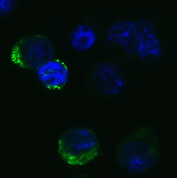 SARS-CoV-2 (COVID-19) Spike RBD Antibody